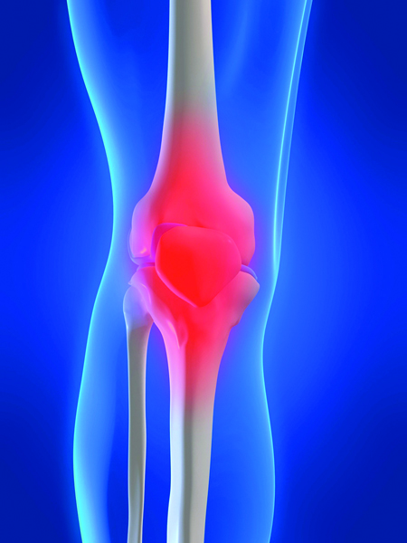 00438751v2 225x300 Hurting joints